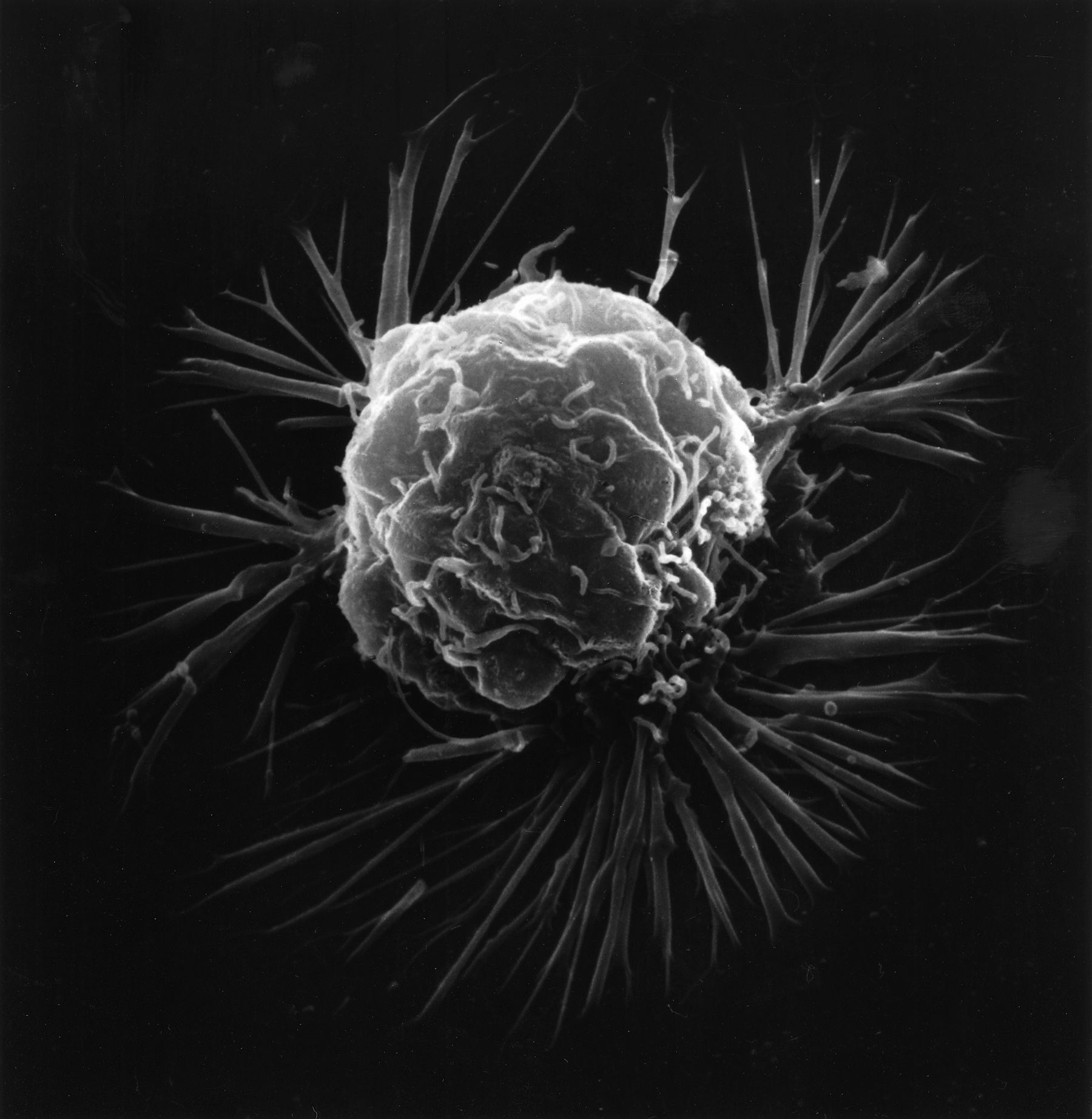 A cancer cell.